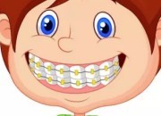 儿童牙齿矫正器的种类与价格大公开，MRC/罗慕/时代天使都在榜