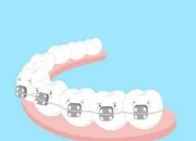 成年人龅牙还可以进行矫正吗？揭晓成年人嘴凸的两种原因。