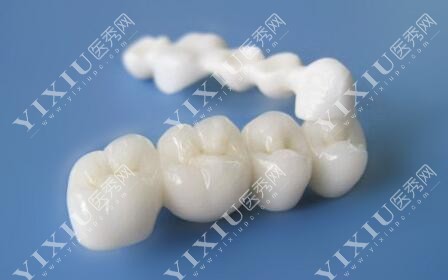 牙冠修复改善全瓷材料