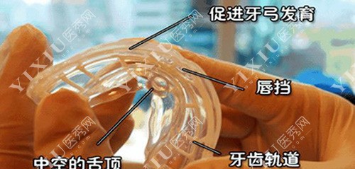 早期干预矫正示意图