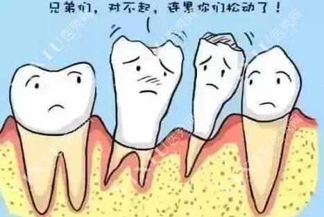 牙齿松动改善治疗展示图