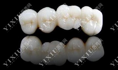 700元/颗起前牙根管治疗:499元起双尖牙根管治疗:680元起磨牙根管治疗