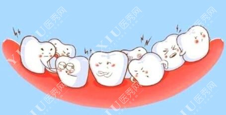 牙齿歪斜正畸改善