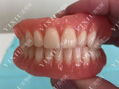 全口BPS吸附性活动假牙