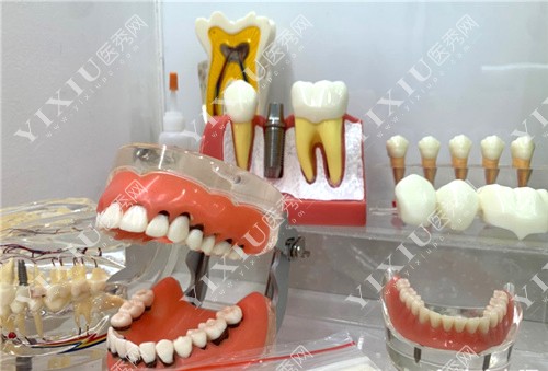 各种不同的牙齿模型