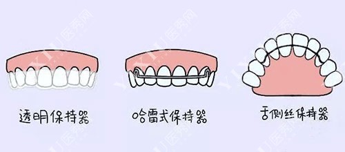 牙齿矫正保持器