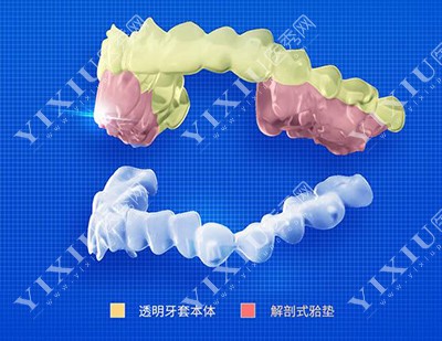 牙齿正畸治疗改善图