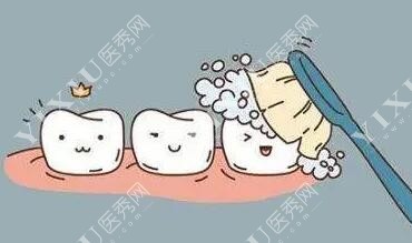 洁牙改善治疗展示图