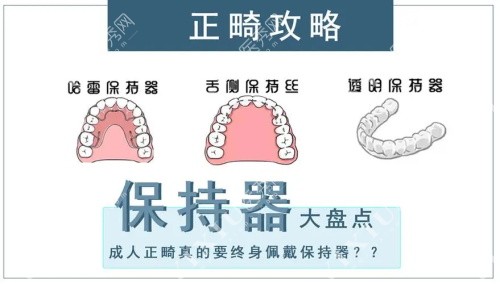 牙齿保持器示意图