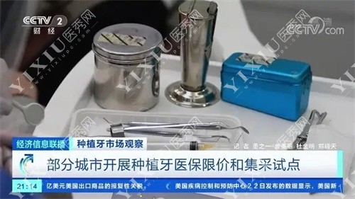 种植牙集采试点新闻截图