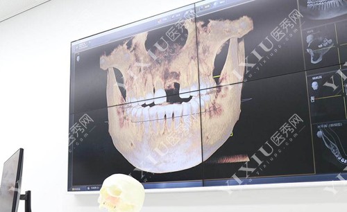 广州广大口腔门诊部种植牙价格公布,种植牙收费不贵技术好!(图5) 广州广大口腔门诊部种植牙价格公布,种植牙收费不贵技术好!(图5)