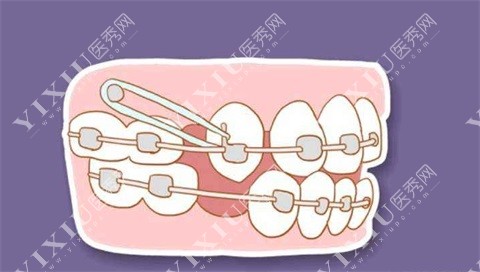 长春华植口腔门诊正畸图