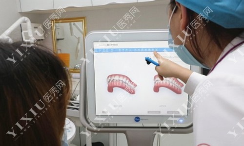 牙齿矫正术前方案图