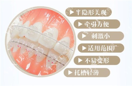 半隐形陶瓷托槽矫正图