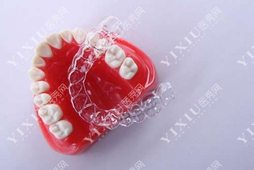 牙齿治疗模型展示