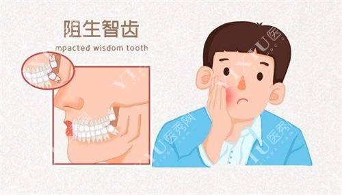深圳爱达口腔智齿拔牙卡通图