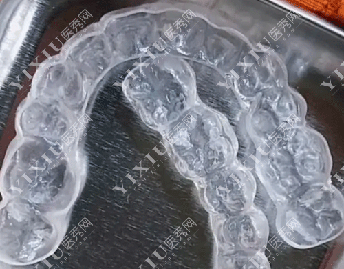 矫正牙齿后戴哪种保持器好 要戴多久?正在矫正牙齿的朋友们看过来(图4) 矫正牙齿后戴哪种保持器好 要戴多久?正在矫正牙齿的朋友们看过来(图4)