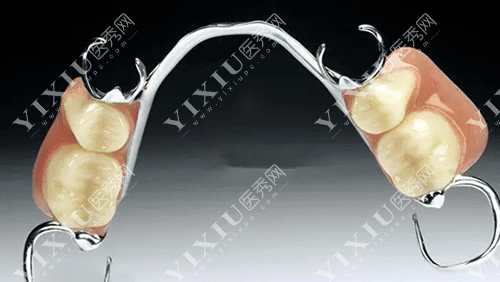 牙齿纯钛支架活动假牙的图片