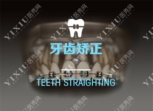 牙齿矫正宣传图