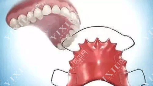 矫正牙齿后戴哪种保持器好 要戴多久?正在矫正牙齿的朋友们看过来(图7) 矫正牙齿后戴哪种保持器好 要戴多久?正在矫正牙齿的朋友们看过来(图7)