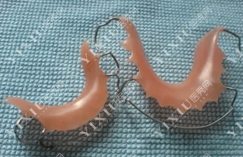 矫正牙齿后戴哪种保持器好 要戴多久?正在矫正牙齿的朋友们看过来(图8) 矫正牙齿后戴哪种保持器好 要戴多久?正在矫正牙齿的朋友们看过来(图8)