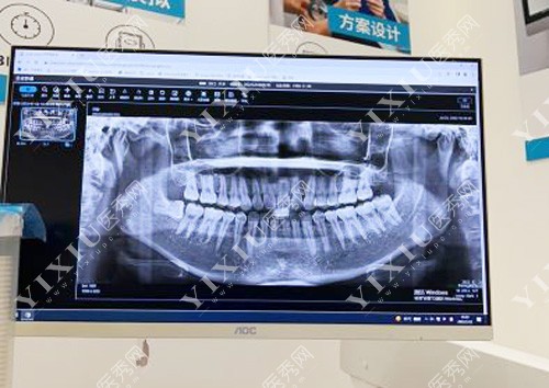 广州马泷齿科牙齿治疗CT图片拍摄
