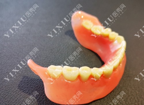 半口义齿照片