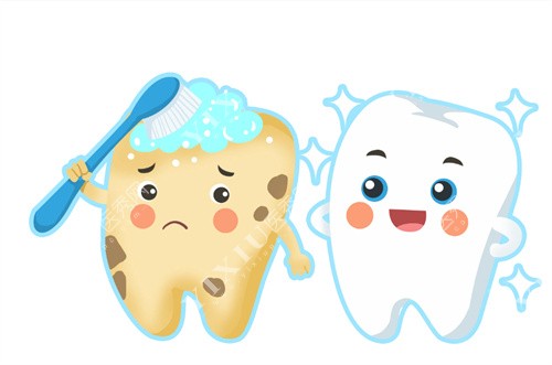 深圳鹏程口腔医院洗牙卡通图