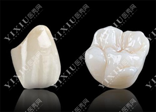 鹏程口腔牙齿全瓷牙示意图