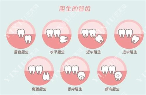 白城欣雅口腔诊所牙齿治疗图