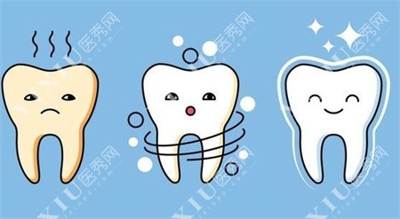 长春传阳口腔洗牙示意图