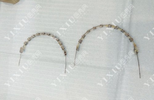 广州盛康口腔牙齿矫正托槽展示