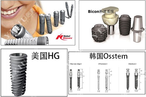 种植牙品牌图