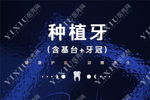 种植牙图