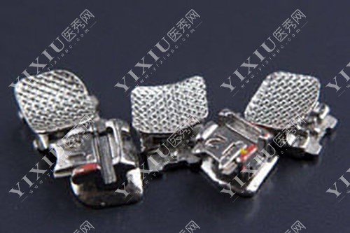 舌侧隐形矫正和无托槽隐形矫正哪个好?聊聊它们的优缺点(图5) 舌侧隐形矫正和无托槽隐形矫正哪个好?聊聊它们的优缺点(图5)