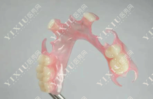 隐形义齿适合年轻人吗 ?看了隐形义齿优缺点及使用期限就秒懂了!(图6) 隐形义齿适合年轻人吗 ?看了隐形义齿优缺点及使用期限就秒懂了!(图6)