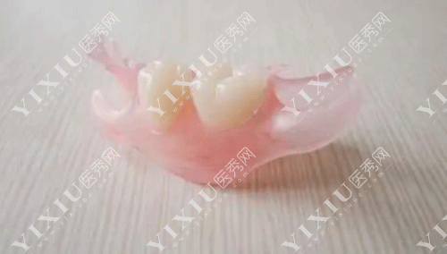 隐形义齿适合年轻人吗 ?看了隐形义齿优缺点及使用期限就秒懂了!(图4) 隐形义齿适合年轻人吗 ?看了隐形义齿优缺点及使用期限就秒懂了!(图4)