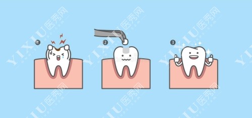 牙齿修复过程卡通图