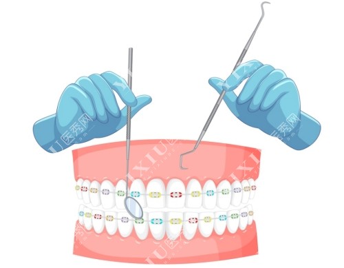 卡通牙齿正畸图