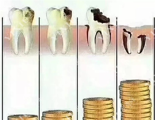 补牙