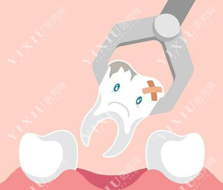 牙齿改善治疗展示图
