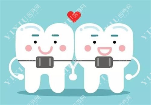 吉林矫正牙齿示意图
