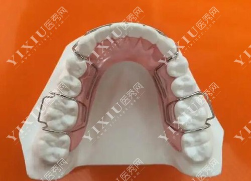 正畸保持器材料图