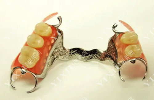 牙齿活动假牙的图片
