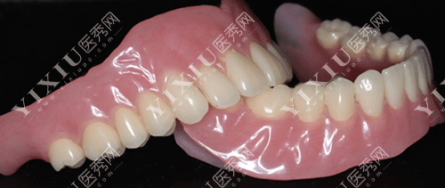 牙齿树脂活动假牙的图片