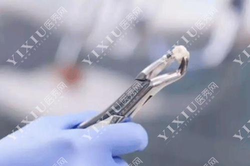 门牙松动了能恢复吗可以固定吗 ?多少钱?(图6) 门牙松动了能恢复吗可以固定吗 ?多少钱?(图6)