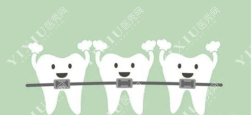 矫正牙齿医生说牙缝关不上怎么回事?科普正畸牙缝关不上原因!(图1) 矫正牙齿医生说牙缝关不上怎么回事?科普正畸牙缝关不上原因!(图1)