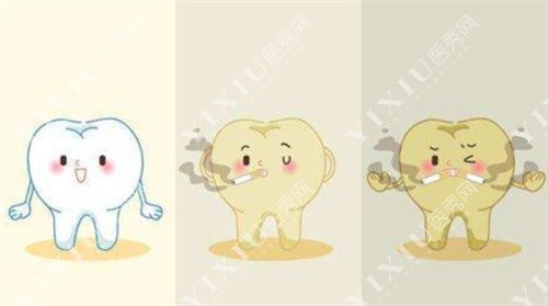 烟渍沉积动漫图