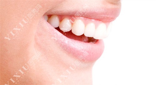 标准牙齿的侧面图图片