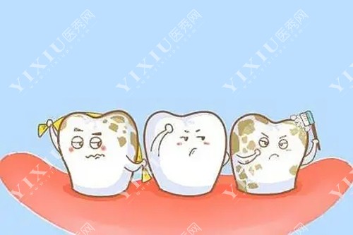 牙齿龋坏卡通图片